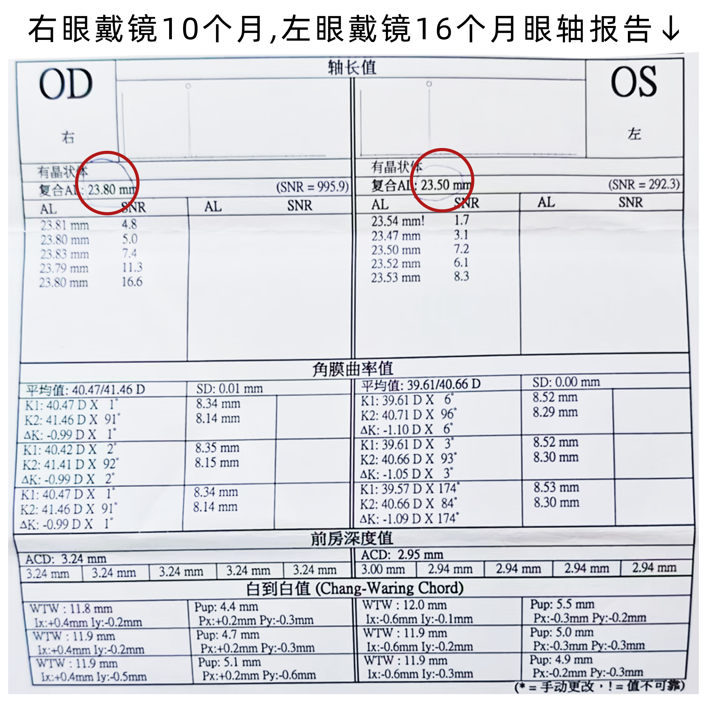 03.右眼10左眼16