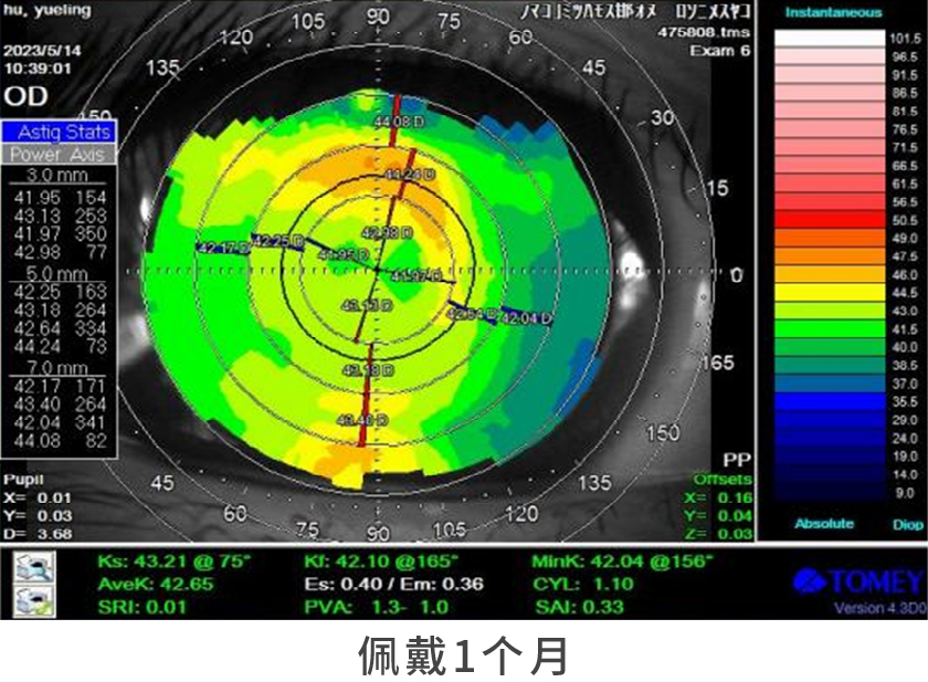 07.佩戴1个月