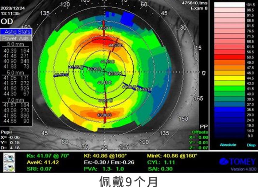 08.佩戴9个月