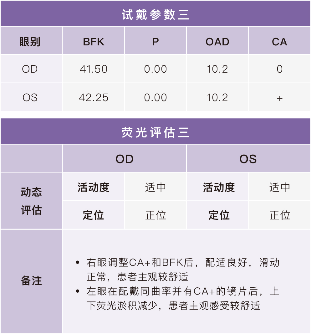 14期插图_第三次试戴